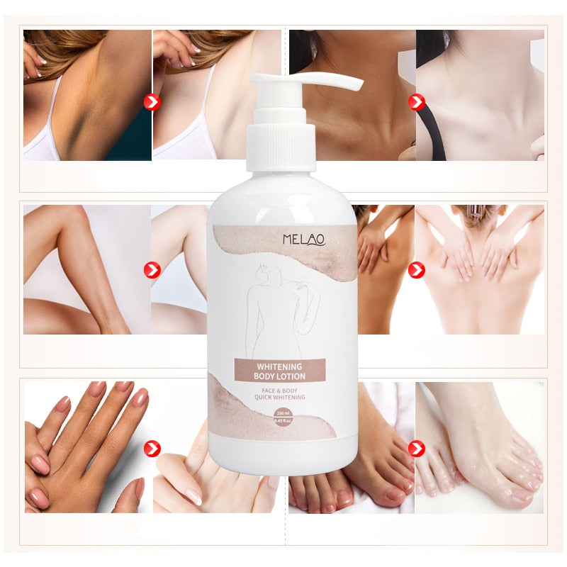 MELAO Body Whitening Lotion Remove Melasma